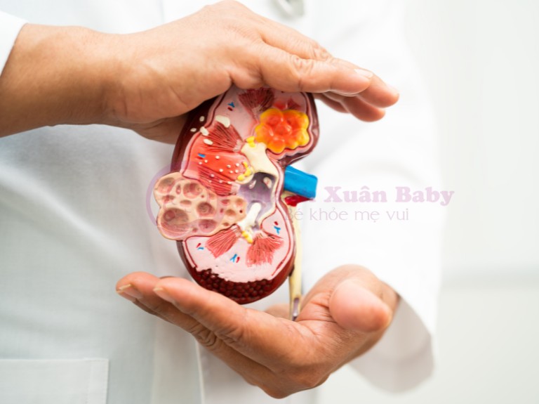 thực phẩm dành cho người suy thận